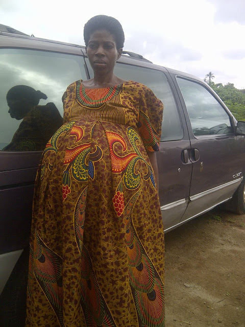 Woman Who Thought She Was Expecting a Baby and Ends Up Having a Giant Fibroid Removed (Photos)