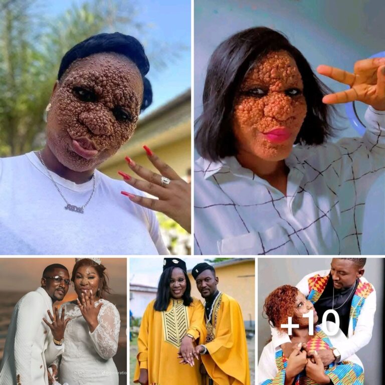 “They said I would never get married because of my looks – Lady says as she shares photos  of her wedding (video)