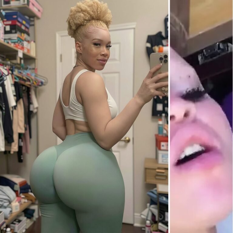The 10 mins albino girl Video Trending
